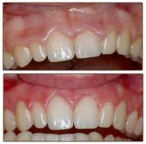 Portage Mi Family Dentist