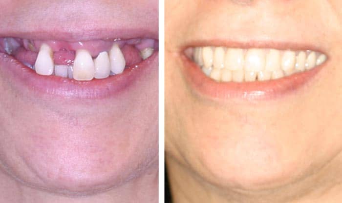 Portage Mi Smile Reconstruction Dentist
